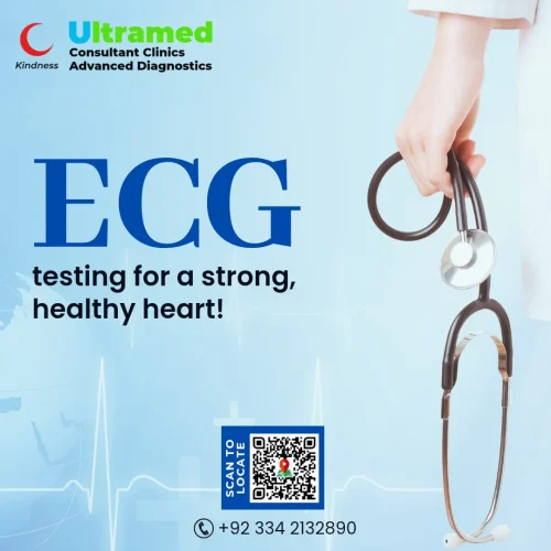 ECG